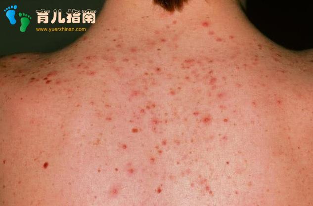 凉席一年没洗太脏了,教你用一秘招,洗完既干净又除螨虫,太棒了