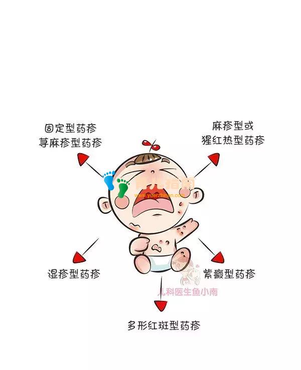 湿疹、热疹、荨麻疹,……各类皮疹都是啥样子?怎么治疗和护理?