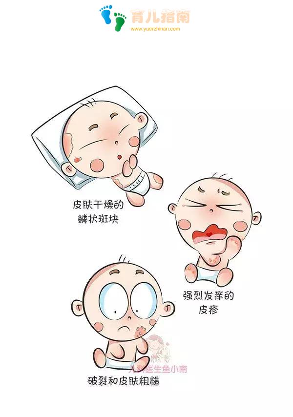 湿疹、热疹、荨麻疹,……各类皮疹都是啥样子?怎么治疗和护理?