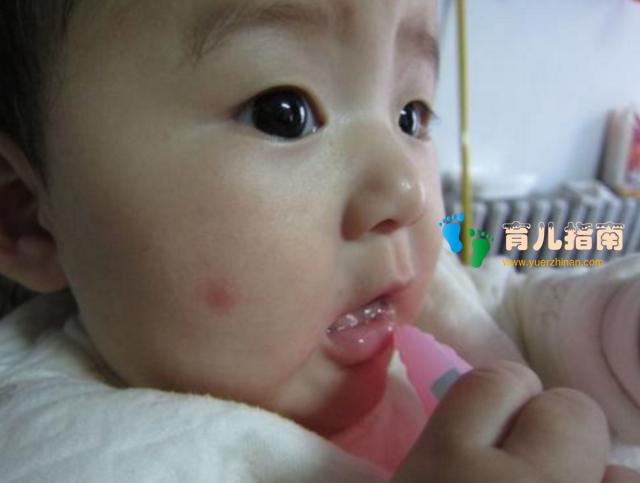 脾虚的宝宝有这几个表现,有经验的宝妈这样调理,宝宝脾虚好得快