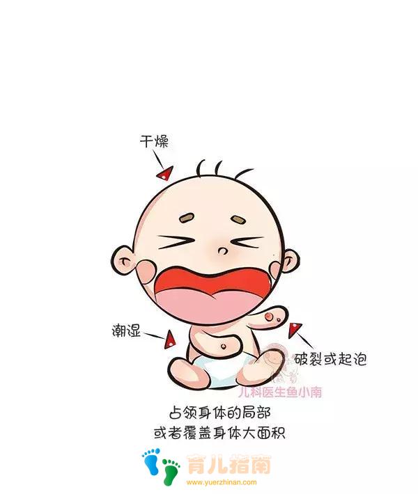 湿疹、热疹、荨麻疹,……各类皮疹都是啥样子?怎么治疗和护理?