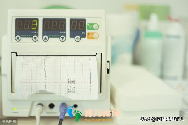 孕晚期产检胎监总不过?做好五个准备,让胎监快速通过