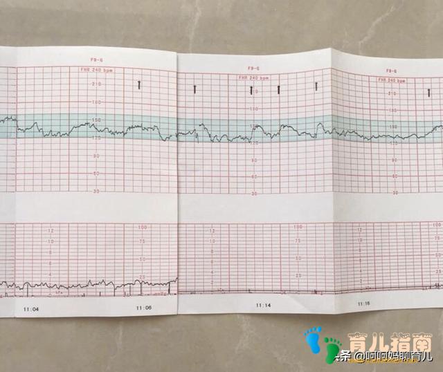 孕晚期产检胎监总不过?做好五个准备,让胎监快速通过