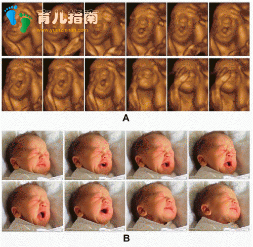 产检从来都没问题，孩子却是问题儿，孕妈妈开始怀疑产检的意义