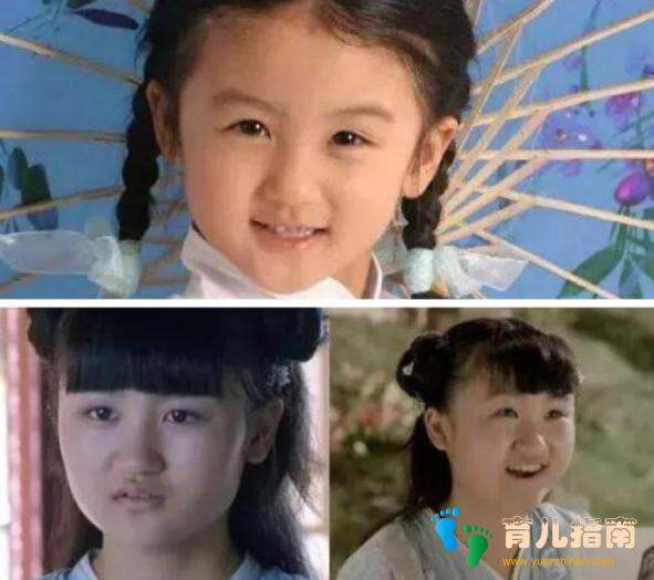 长相有这几个特征的孩子会越长越好看,看看自家孩子占了几样