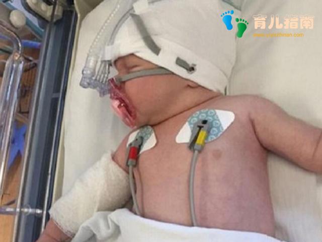 婴儿哭声不对劲被及时送医，看似小题大做的举动，却救了孩子的命