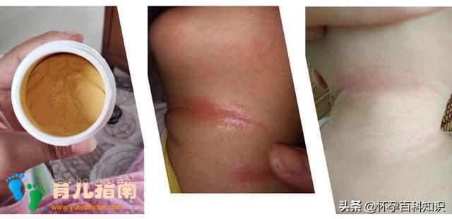 宝宝脖子淹红、哭闹不止!!抬头,就可以预防淹脖子”?