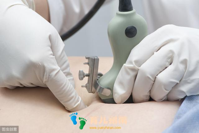 如何预防染色体异常胎儿的出生?这些方法为你保驾护航