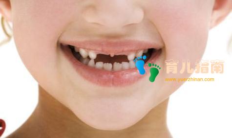 这七类含游离糖”食物正伤害孩子牙齿,很多家长每天都给孩子吃