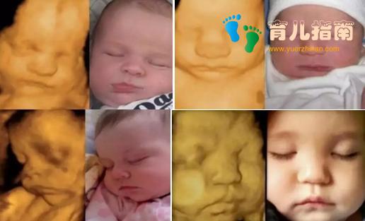 宝宝四维照片丑哭,生出来会不会丑?孕妈知道原因后破涕为笑!