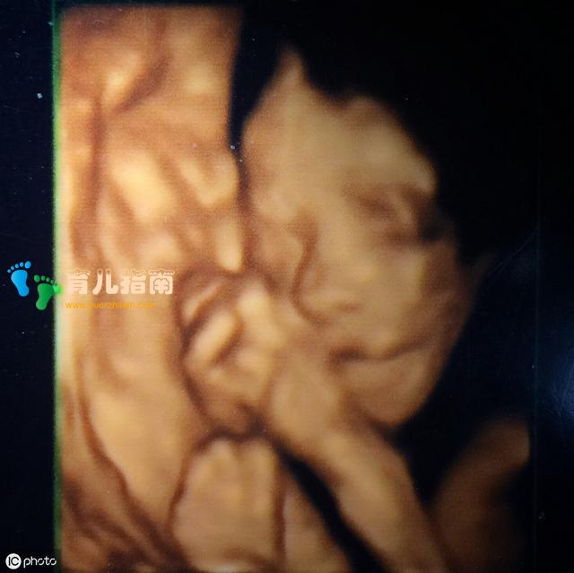 宝宝四维照片丑哭,生出来会不会丑?孕妈知道原因后破涕为笑!
