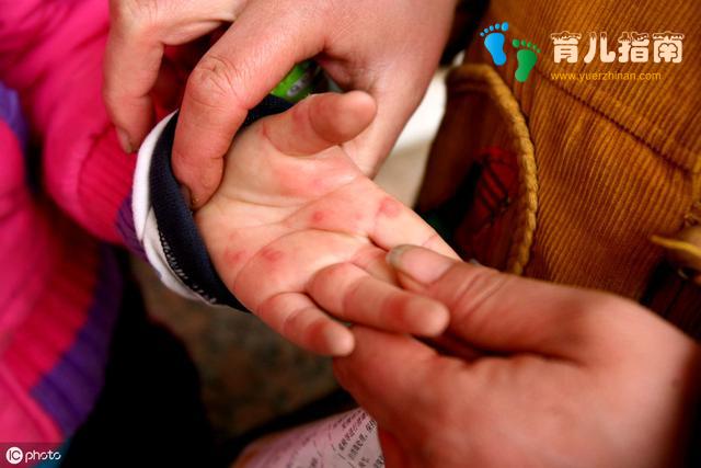 你以为孩子只是普通感冒,却不知他可能在和死神赛跑