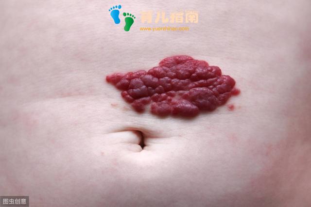 你以为孩子只是普通感冒,却不知他可能在和死神赛跑