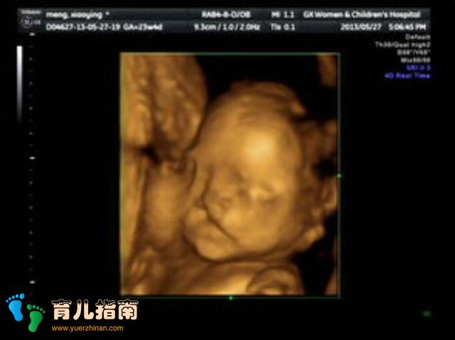 做B超看见胎儿一直在笑，以为宝宝很聪明，医生看了却叹了口气