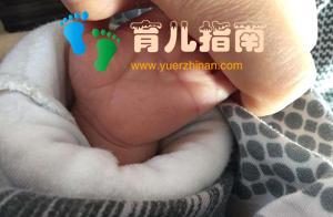 孩子出生后是断掌,婆婆说长大一定有出息,体检后却高兴不起来了