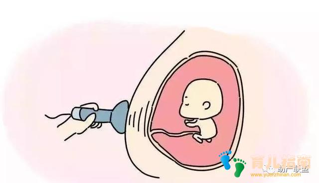 NT检查这么重要,但是超过这个孕周就没用了!你知道吗?