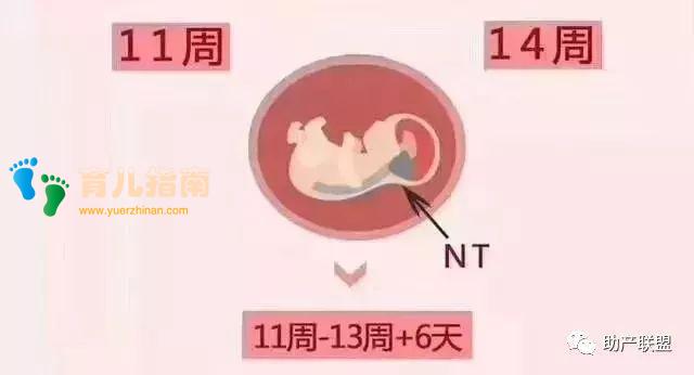 NT检查这么重要,但是超过这个孕周就没用了!你知道吗?