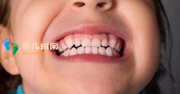 #清风计划# 孩子为什么会流口水?口水流得太多,有什么问题?