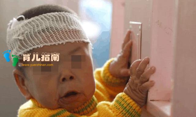 &quot;侏儒夫妻&quot;怀孕执意生孩子，等到分娩看到孩子后，后悔没听医生的