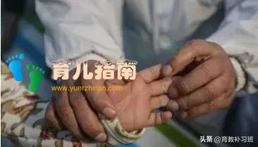 4岁宝宝没了双腿用手走路,手上布满了老茧,坚强的笑容让人心疼