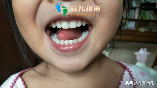 牙齿好的孩子,都有这5个共同点,跟其他没关系