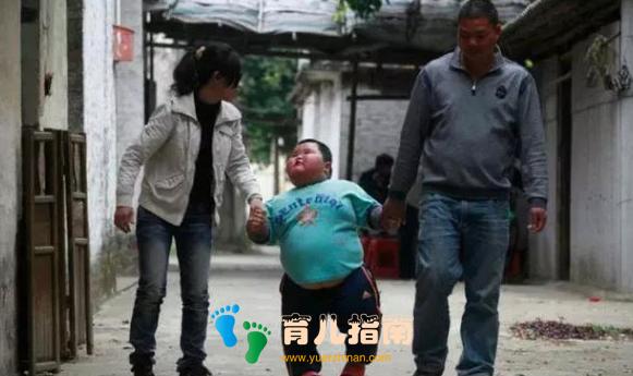 中国最胖的儿童,3岁120斤,散步都很吃力