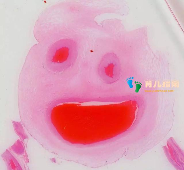 脐带对胎儿有多重要？怀孕中脐带可能会出现的六大问题，请查看