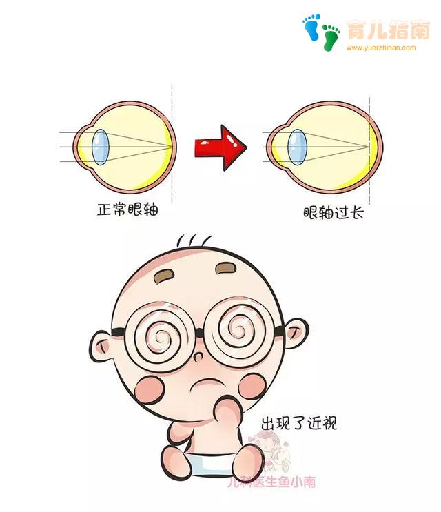 预防近视 预防近视