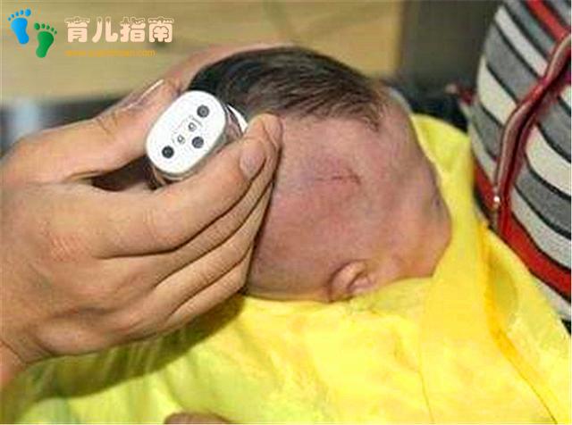奶奶给宝宝剃&quot;满月头&quot;，结果头发再也没长出来：医生：瞎胡闹