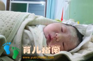 隐性基因 隐性基因