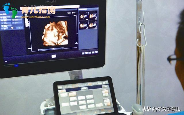 人工选择 人工选择