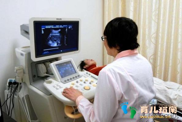 胎儿性别 胎儿性别