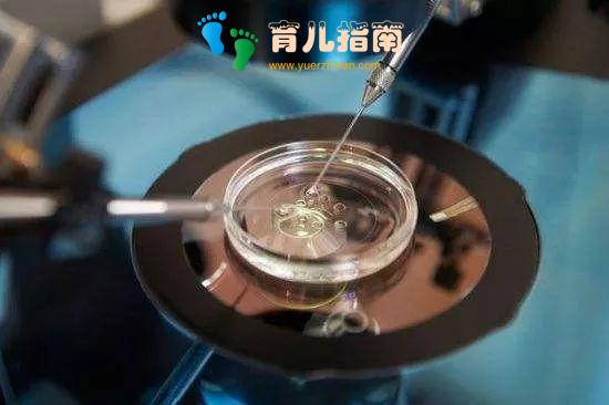 改善生活方式 改善生活方式