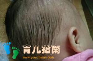 婴儿为什么总是很热、爱出汗？总是喜欢长痱子？该怎么办？