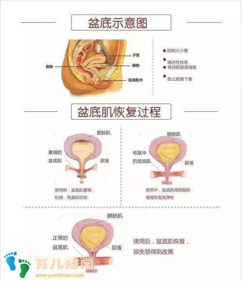 盆底康复 盆底康复