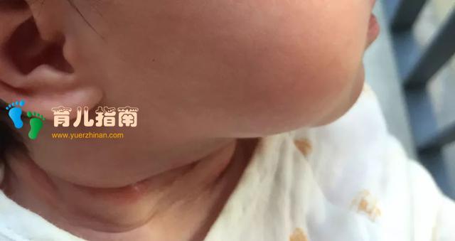 宝宝淹脖子”怎么办?拒绝土方法,看看这几招 宝宝淹脖子”怎么办?拒绝土方法,看看这几招