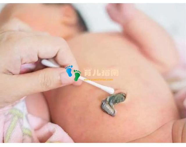 脐带创口 脐带创口