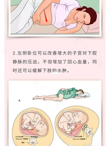 孕妈妈的睡眠时间及体位很重要