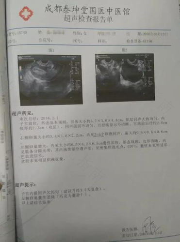 如何诊断和治疗不孕症