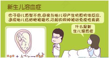 母婴血型不合该如何进行防治 母婴血型不合该如何进行防治