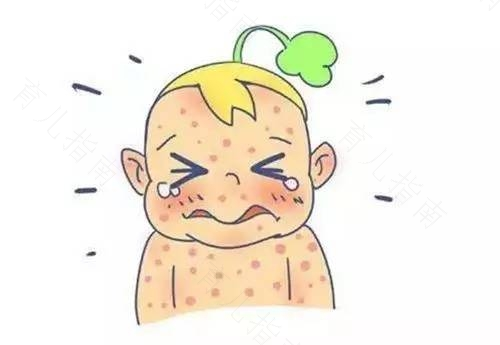 宝宝患过敏性皮炎如何护理