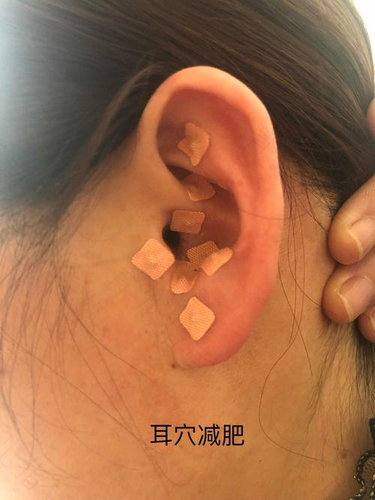 如何通过耳穴诊断健康 如何通过耳穴诊断健康