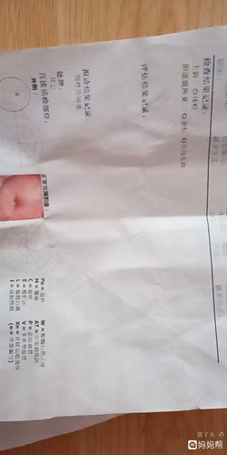 育龄妇女常见病宫颈炎的症状