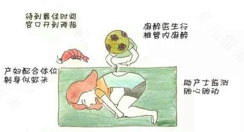 产妇需要了解的辅助分娩的四种措施