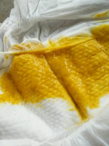 育儿小窍门:用便便颜色看出潜在问题 育儿小窍门:用便便颜色看出潜在问题