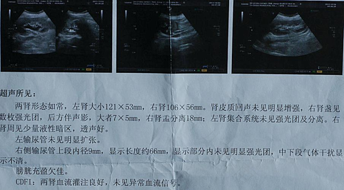 孕妇患了肾结石该怎么办 孕妇患了肾结石该怎么办