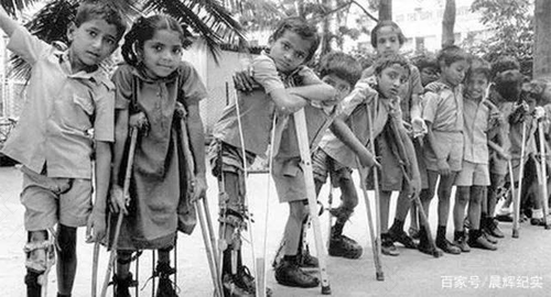 如何对小儿麻痹症进行防治 如何对小儿麻痹症进行防治