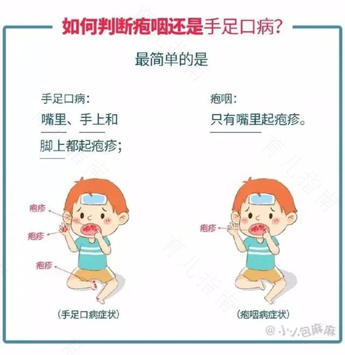 如何辨别儿童的发病症状