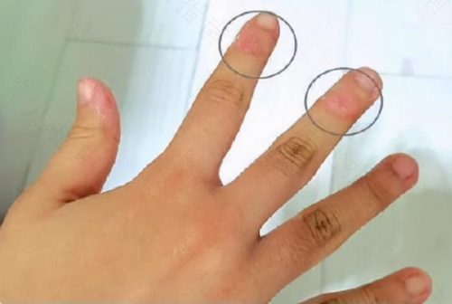 宝宝总是钟爱吃手指怎么办