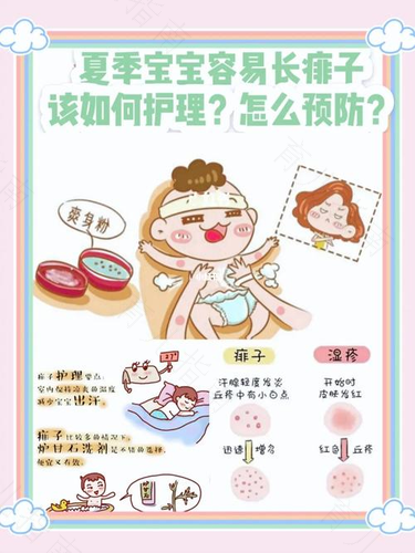 夏季别让宝宝被痱子打扰